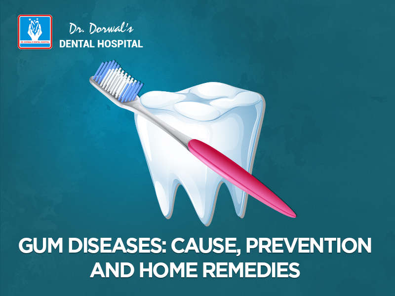 Get the Successful Treatment of Gum Disease by Famous Dentist in Jaipur